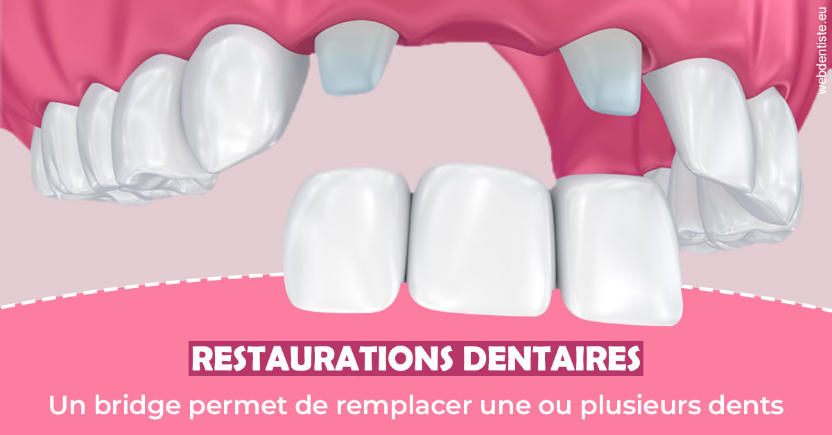 https://dr-paul-graindorge.chirurgiens-dentistes.fr/Bridge remplacer dents 2