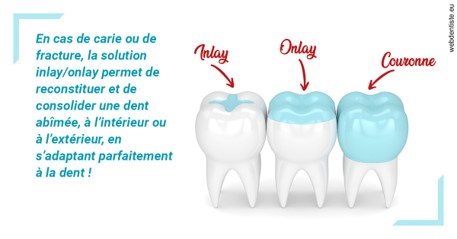 https://dr-paul-graindorge.chirurgiens-dentistes.fr/L'INLAY ou l'ONLAY