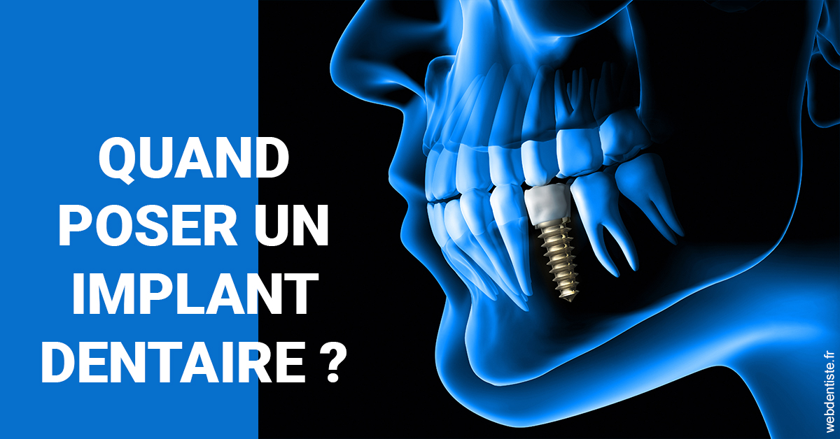 https://dr-paul-graindorge.chirurgiens-dentistes.fr/Les implants 1