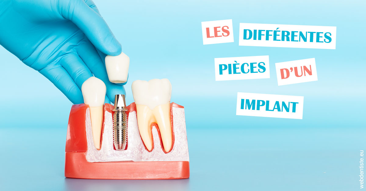 https://dr-paul-graindorge.chirurgiens-dentistes.fr/Les différentes pièces d’un implant 2