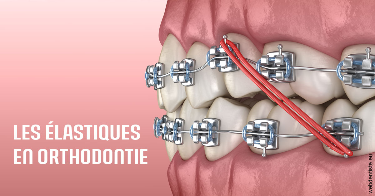 https://dr-paul-graindorge.chirurgiens-dentistes.fr/Elastiques orthodontie 2