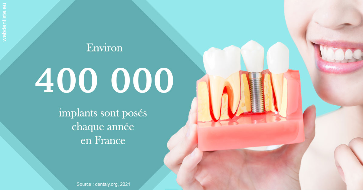 https://dr-paul-graindorge.chirurgiens-dentistes.fr/Pose d'implants en France 2